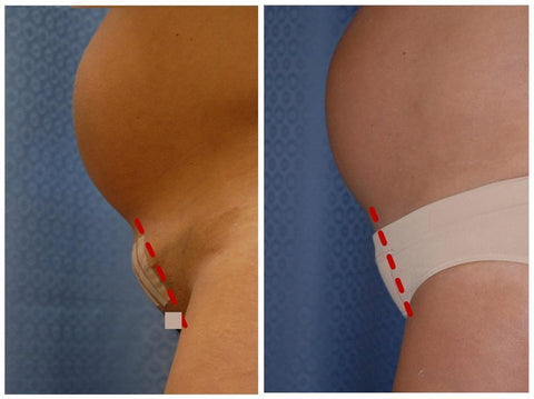 C-Panty Classic waist - 2 Pack - mild medical compression